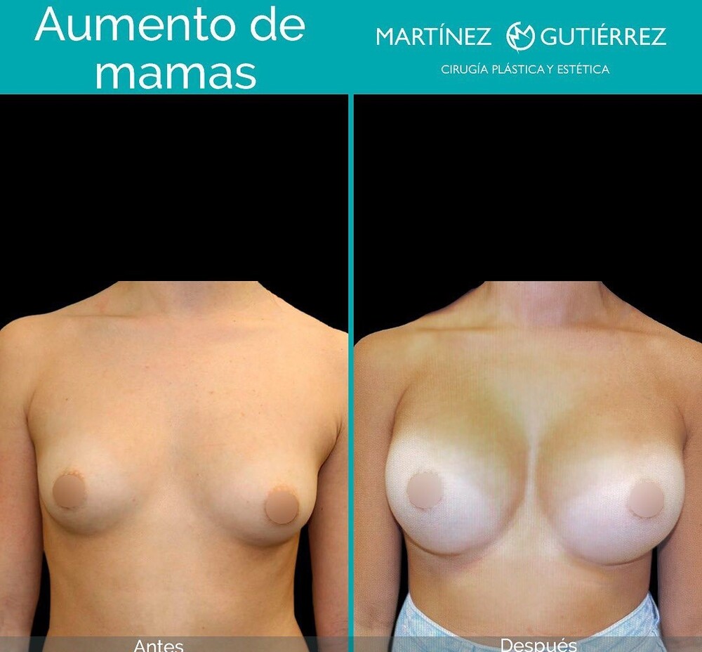 Before and After Result